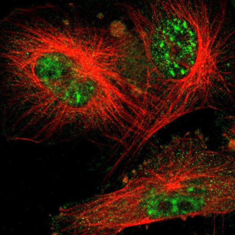 UBE2R1/CDC34 Antibody - BSA Free Immunocytochemistry/ Immunofluorescence: UBE2R1/CDC34 Antibody [NBP1-84946]