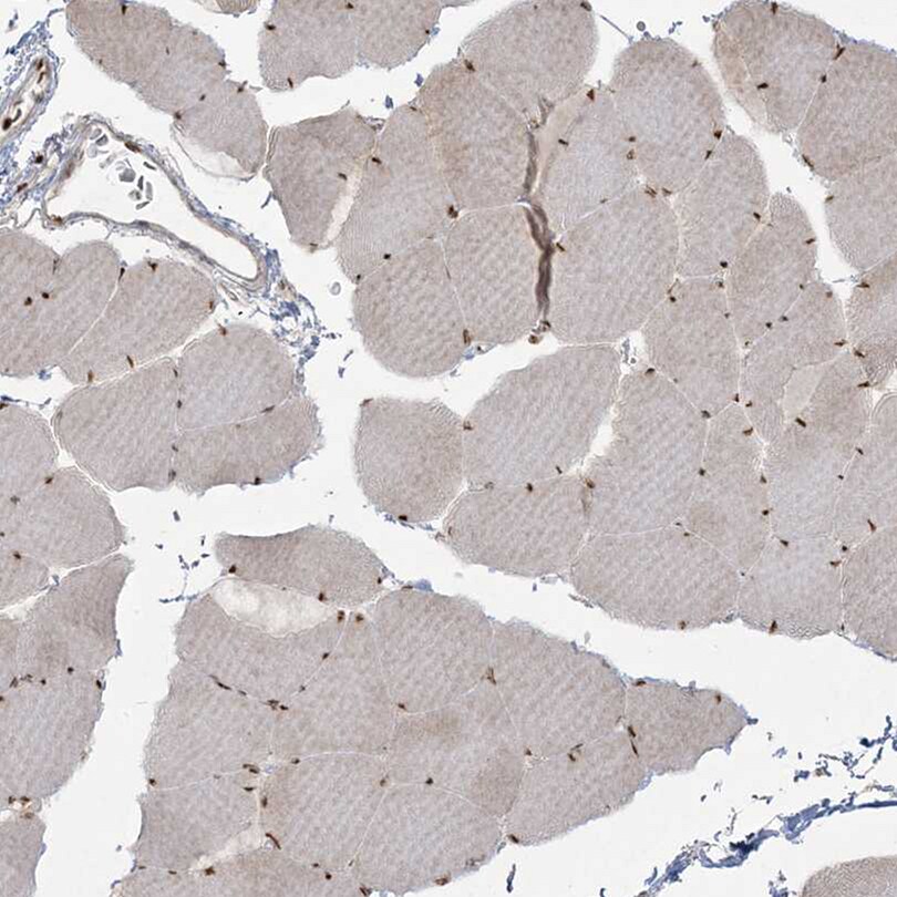 RBM10 Antibody - BSA Free Immunohistochemistry-Paraffin: RBM10 Antibody [NBP1-84951]
