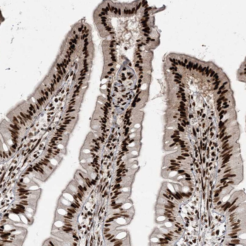 RBM10 Antibody - BSA Free Immunohistochemistry-Paraffin: RBM10 Antibody [NBP1-84951]