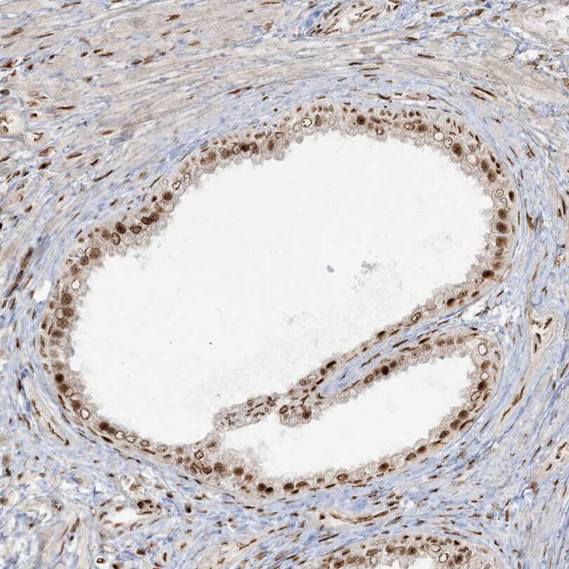 RBM10 Antibody - BSA Free Immunohistochemistry-Paraffin: RBM10 Antibody [NBP1-84951]