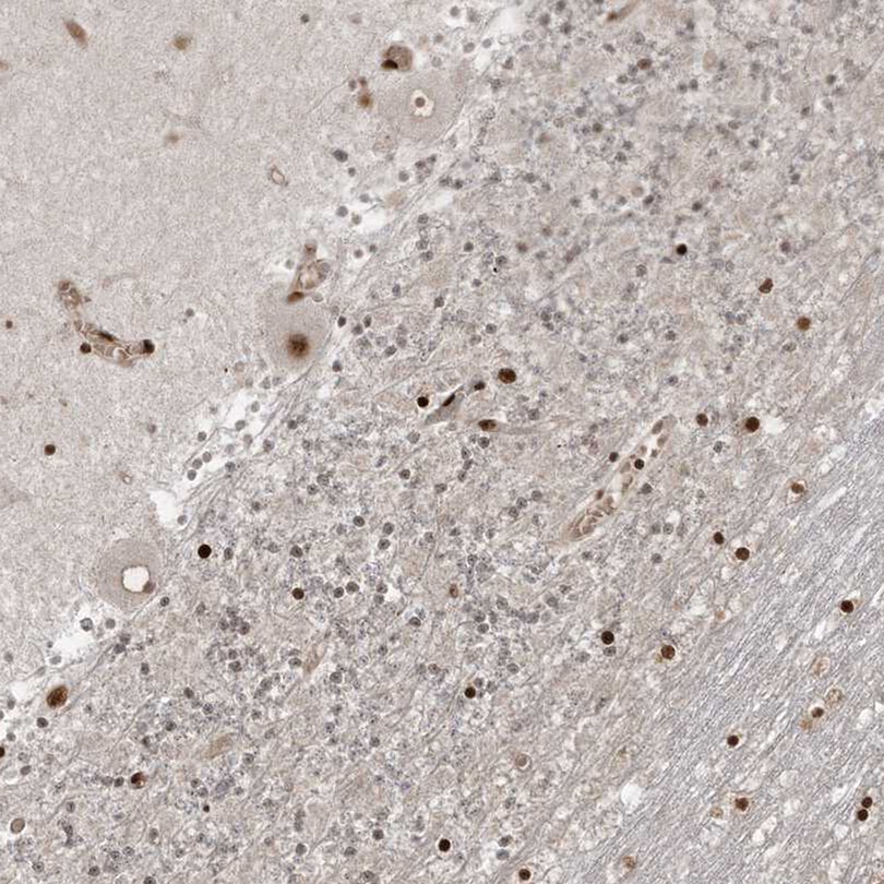 RBM10 Antibody - BSA Free Immunohistochemistry-Paraffin: RBM10 Antibody [NBP1-84951]