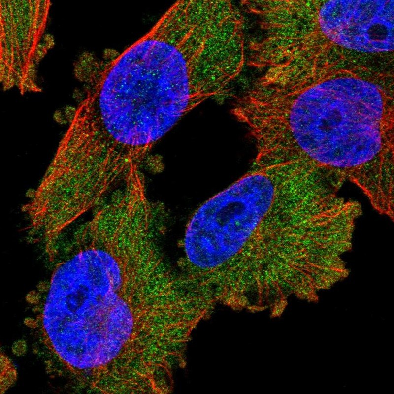 PKC iota Antibody - BSA Free Immunocytochemistry/ Immunofluorescence: PKC iota Antibody [NBP1-84959]