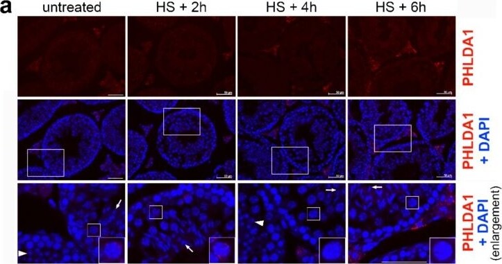 PHLDA1 Antibody