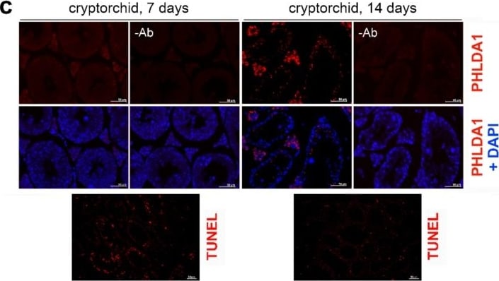 PHLDA1 Antibody