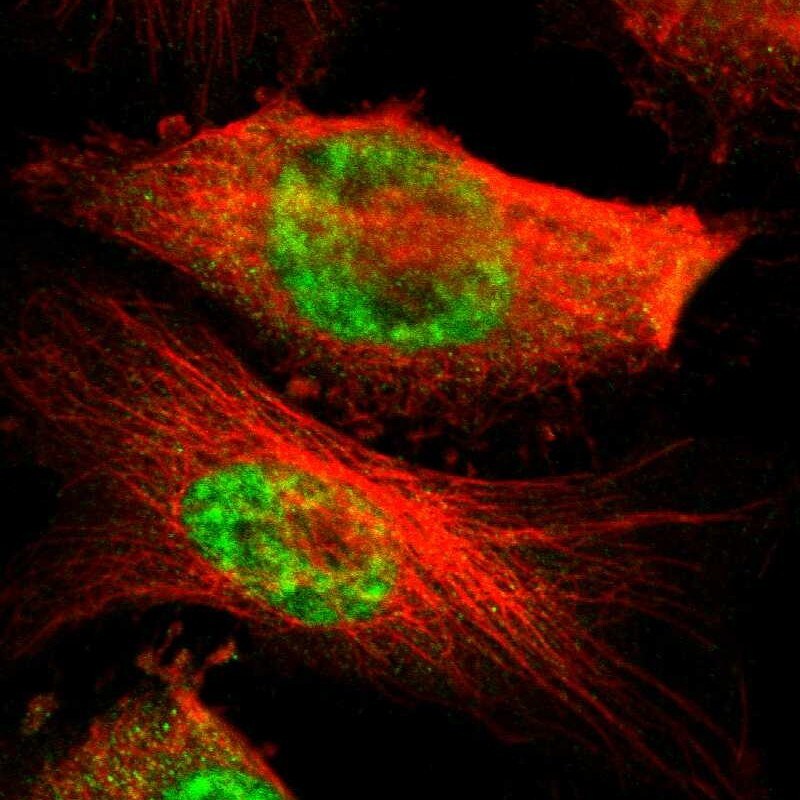 MED4 Antibody - BSA Free Immunocytochemistry/ Immunofluorescence: MED4 Antibody [NBP1-84977]