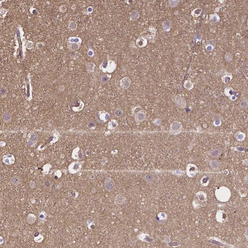 CRMP1 Antibody - BSA Free Immunohistochemistry-Paraffin: CRMP1 Antibody [NBP1-84985]