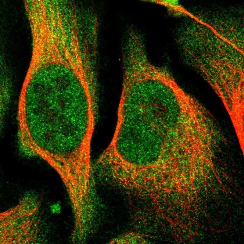 COASY Antibody - BSA Free Immunocytochemistry/ Immunofluorescence: COASY Antibody [NBP1-84990]