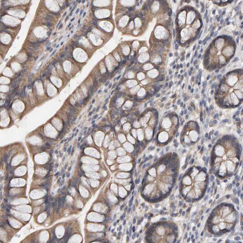 COASY Antibody - BSA Free Immunohistochemistry-Paraffin: COASY Antibody [NBP1-84991]