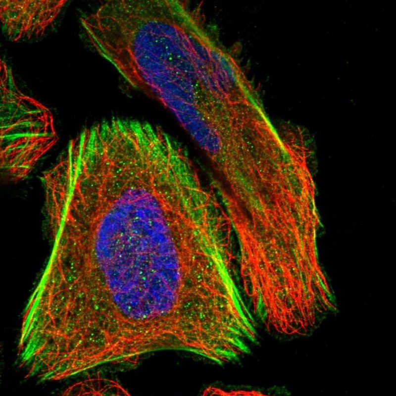 SCNN1D Antibody - BSA Free Immunocytochemistry/ Immunofluorescence: SCNN1D Antibody [NBP1-85004]