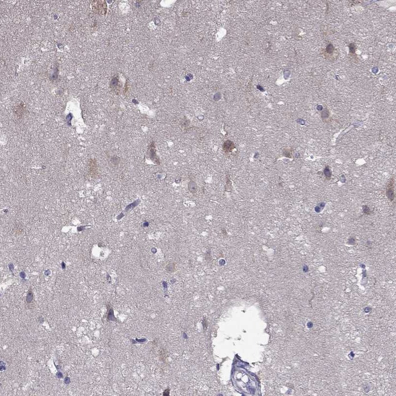 SCNN1D Antibody - BSA Free Immunohistochemistry-Paraffin: SCNN1D Antibody [NBP1-85004]