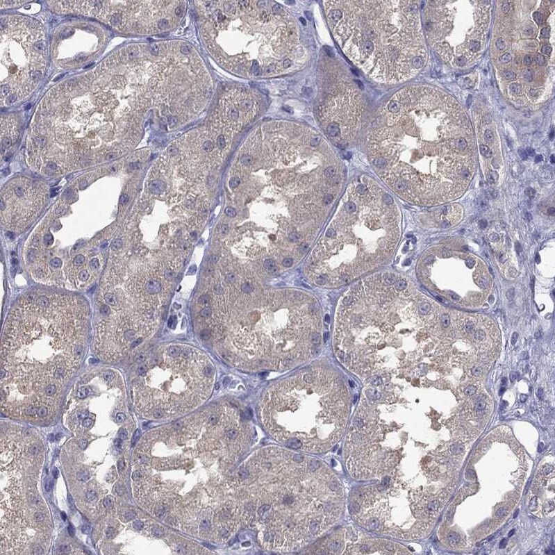 SCNN1D Antibody - BSA Free Immunohistochemistry-Paraffin: SCNN1D Antibody [NBP1-85004]