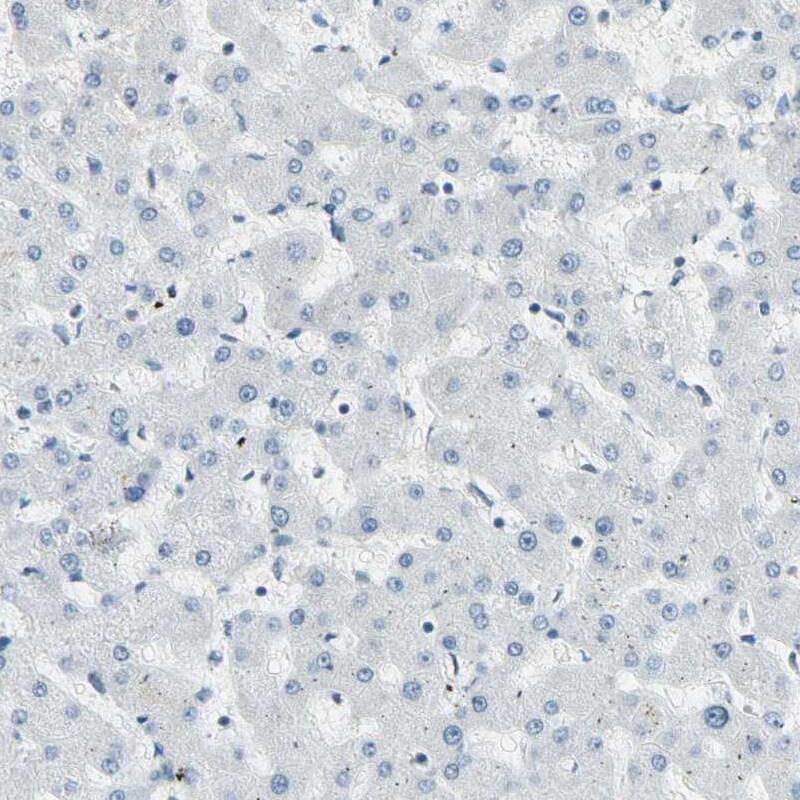 RNF43 Antibody - BSA Free Immunohistochemistry-Paraffin: RNF43 Antibody [NBP1-85018]