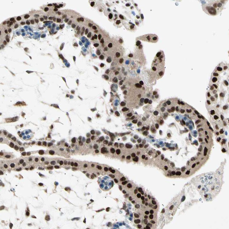 RNF43 Antibody - BSA Free Immunohistochemistry-Paraffin: RNF43 Antibody [NBP1-85018]