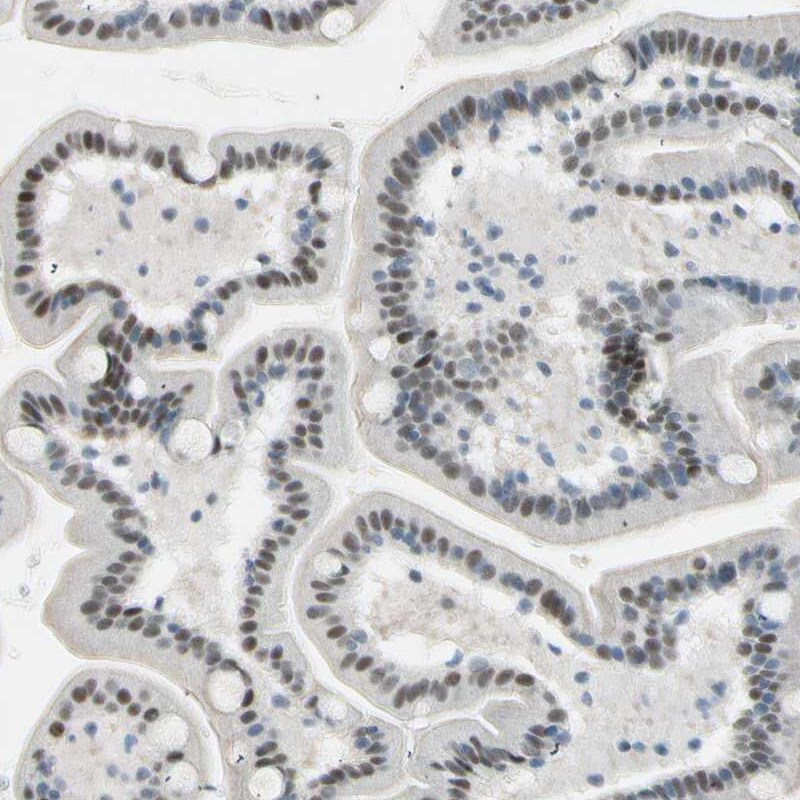 RNF43 Antibody - BSA Free Immunohistochemistry-Paraffin: RNF43 Antibody [NBP1-85018]