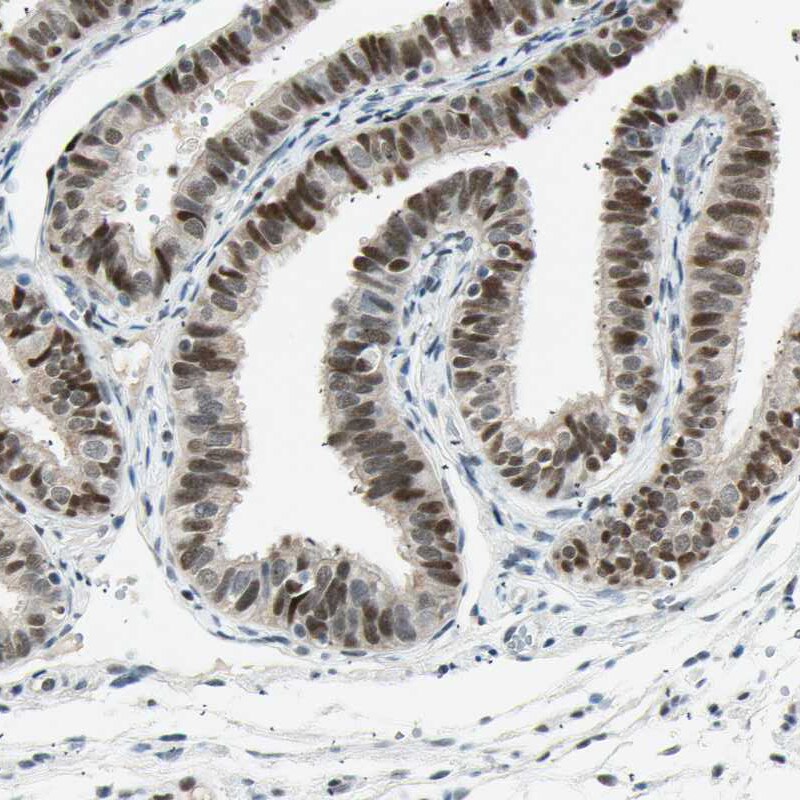 RNF43 Antibody - BSA Free Immunohistochemistry-Paraffin: RNF43 Antibody [NBP1-85018]