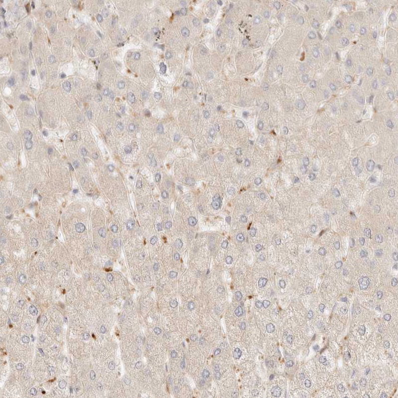 TMTC2 Antibody - BSA Free Immunohistochemistry-Paraffin: TMTC2 Antibody [NBP1-85027]