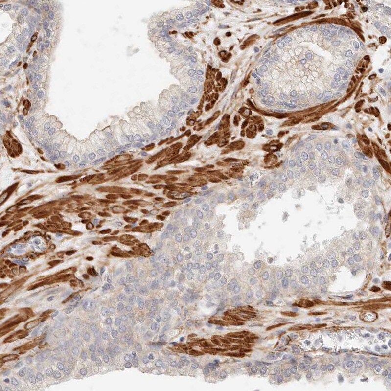 TMTC2 Antibody - BSA Free Immunohistochemistry-Paraffin: TMTC2 Antibody [NBP1-85027]
