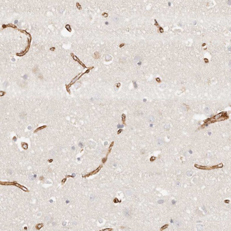 TMTC2 Antibody - BSA Free Immunohistochemistry-Paraffin: TMTC2 Antibody [NBP1-85027]