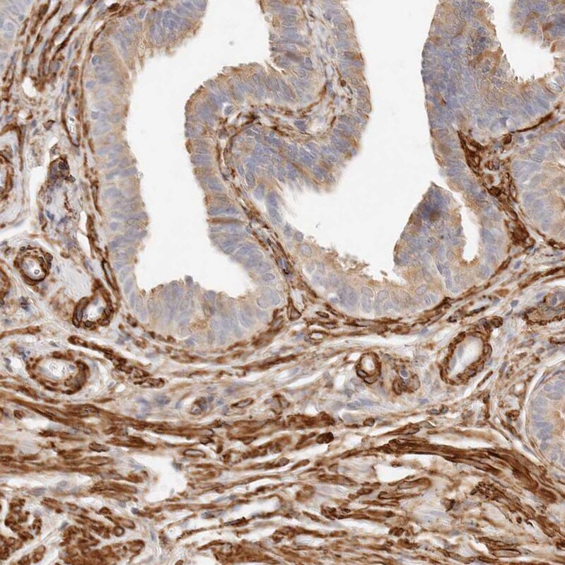 TMTC2 Antibody - BSA Free Immunohistochemistry-Paraffin: TMTC2 Antibody [NBP1-85027]