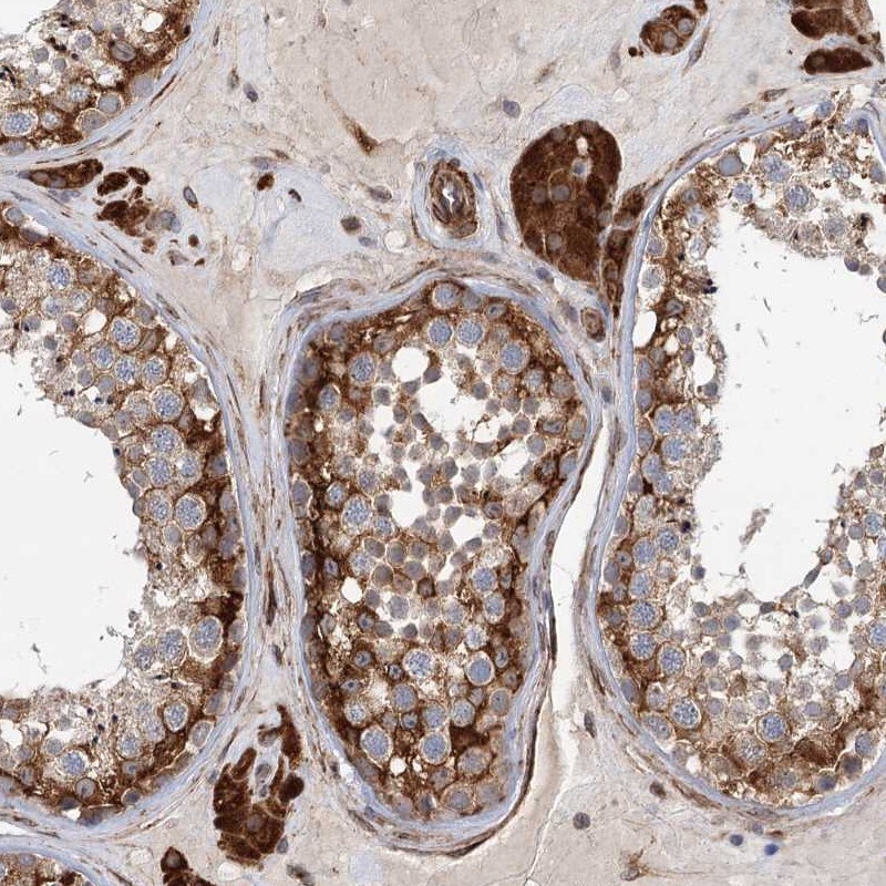 LRRC56 Antibody - BSA Free Immunohistochemistry: LRRC56 Antibody - BSA Free [NBP1-85030]
