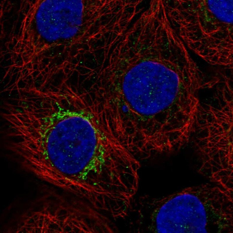 MPP2 Antibody - BSA Free Immunocytochemistry/ Immunofluorescence: MPP2 Antibody [NBP1-85038]