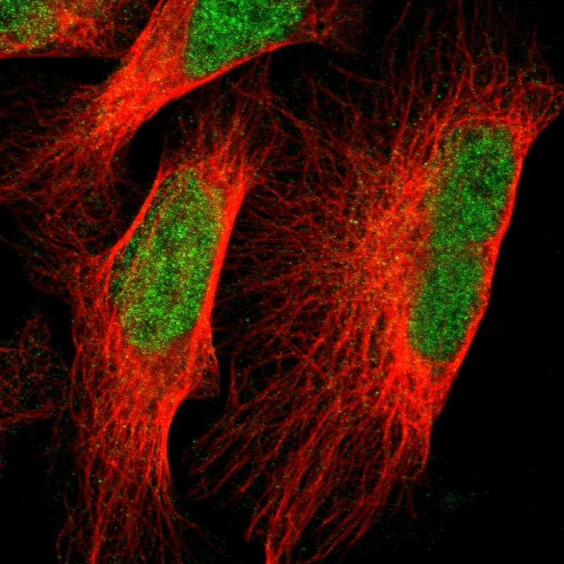 VEZT Antibody - BSA Free Immunocytochemistry/ Immunofluorescence: VEZT Antibody [NBP1-85040]