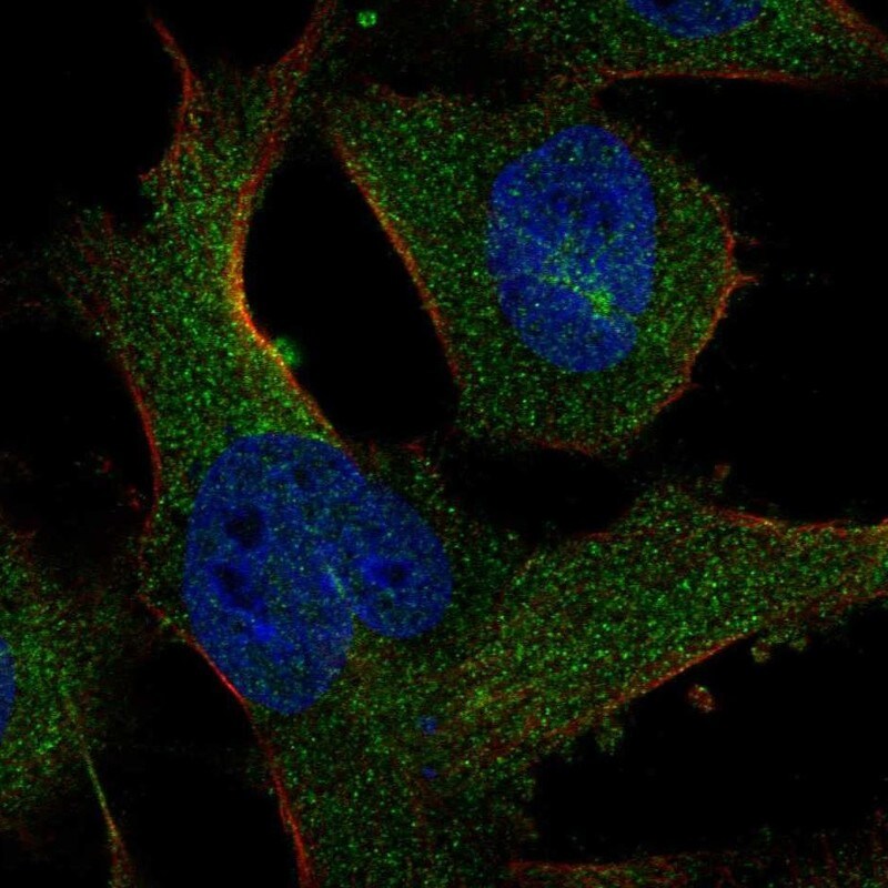 SASS6 Antibody - BSA Free Immunocytochemistry/ Immunofluorescence: SASS6 Antibody [NBP1-85043]