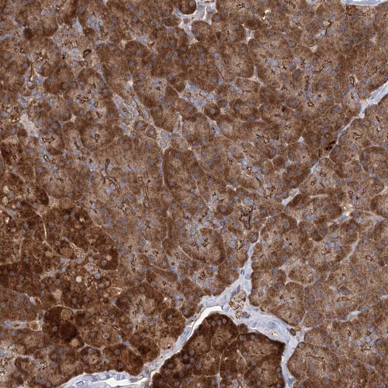 PLEKHA7 Antibody - BSA Free Immunohistochemistry-Paraffin: PLEKHA7 Antibody [NBP1-85045]