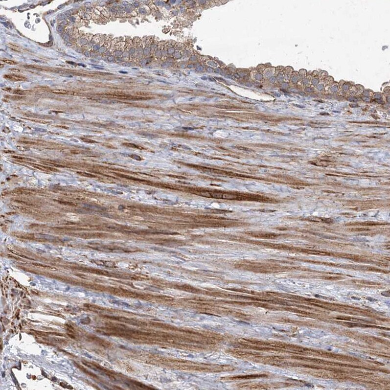 PLEKHA7 Antibody - BSA Free Immunohistochemistry-Paraffin: PLEKHA7 Antibody [NBP1-85045]
