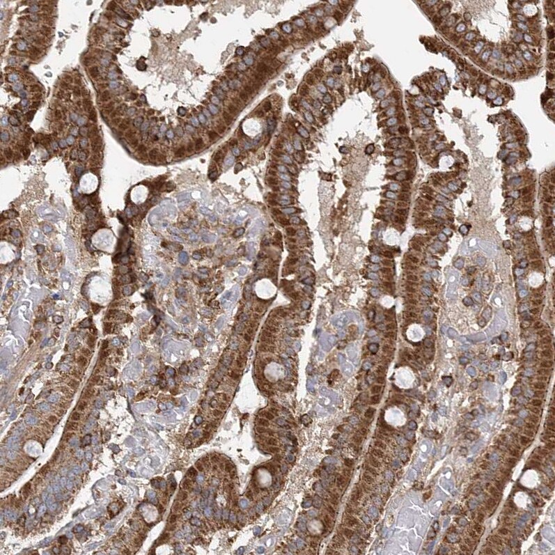 PLEKHA7 Antibody - BSA Free Immunohistochemistry-Paraffin: PLEKHA7 Antibody [NBP1-85045]