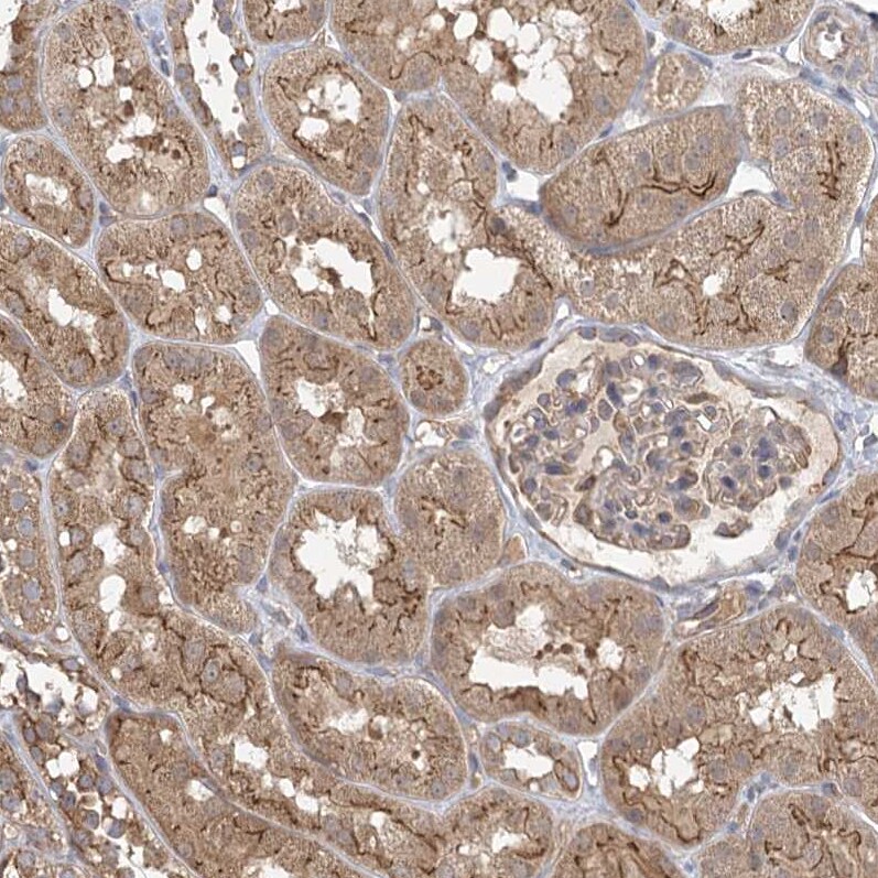 PLEKHA7 Antibody - BSA Free Immunohistochemistry-Paraffin: PLEKHA7 Antibody [NBP1-85045]