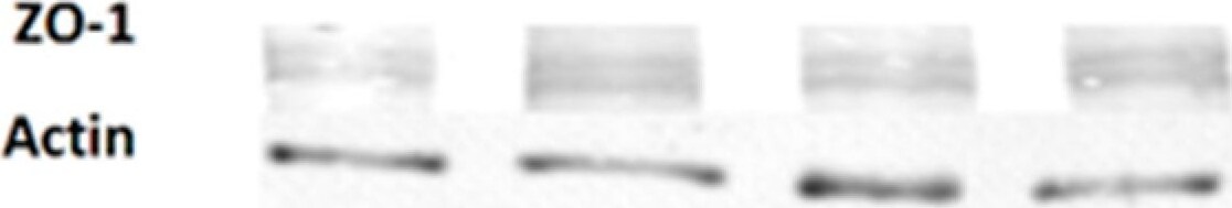 Tight Junction Protein 1 Antibody