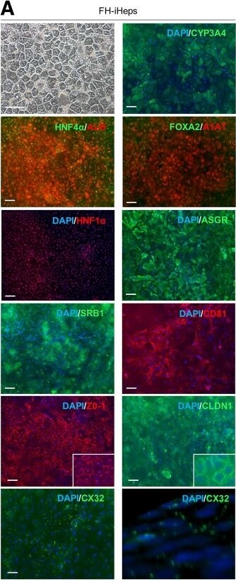 Tight Junction Protein 1 Antibody