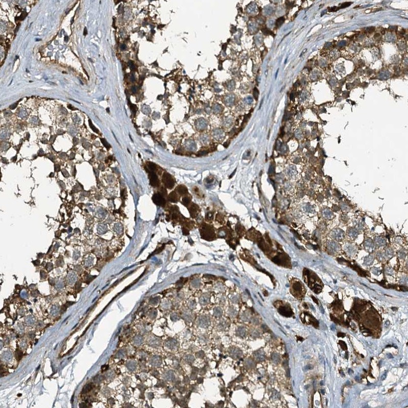 TPGS2 Antibody - BSA Free Immunohistochemistry-Paraffin: TPGS2 Antibody [NBP1-85063]