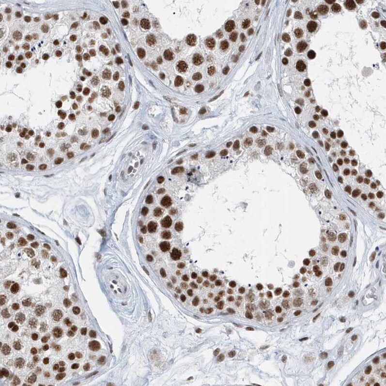 FIP1L1 Antibody - BSA Free Immunohistochemistry-Paraffin: FIP1L1 Antibody [NBP1-85064]