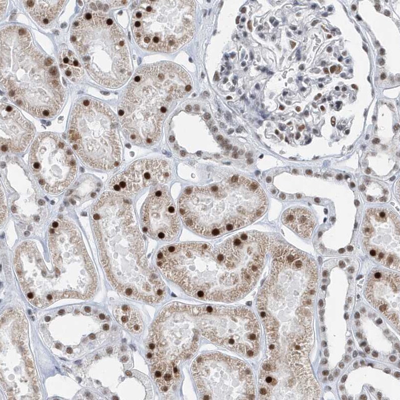FIP1L1 Antibody - BSA Free Immunohistochemistry-Paraffin: FIP1L1 Antibody [NBP1-85064]