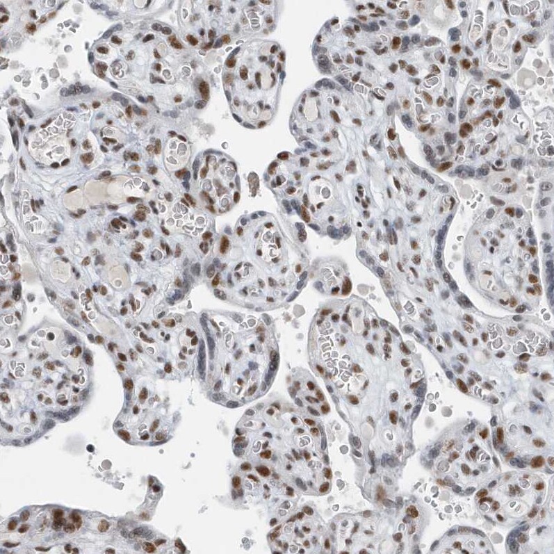 FIP1L1 Antibody - BSA Free Immunohistochemistry-Paraffin: FIP1L1 Antibody [NBP1-85064]