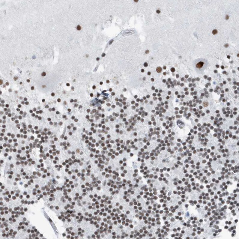 FIP1L1 Antibody - BSA Free Immunohistochemistry-Paraffin: FIP1L1 Antibody [NBP1-85064]