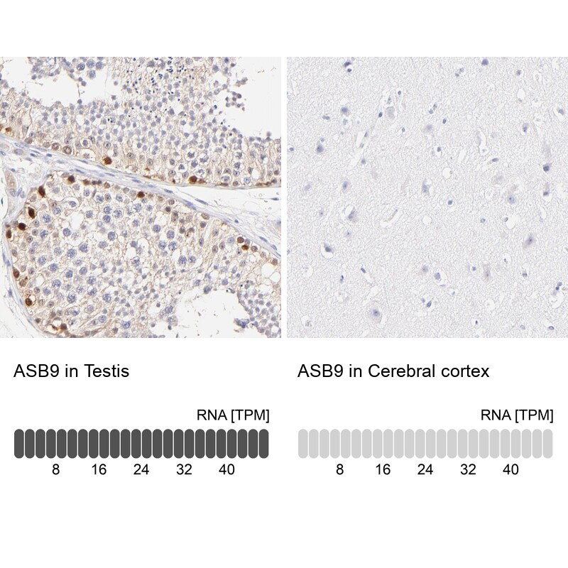 ASB9 Antibody - BSA Free Immunohistochemistry-Paraffin: ASB9 Antibody [NBP1-85081]