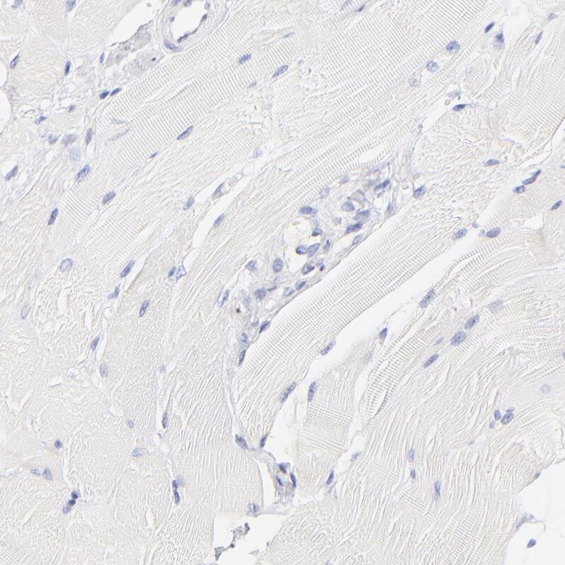 ASB9 Antibody - BSA Free Immunohistochemistry-Paraffin: ASB9 Antibody [NBP1-85081]