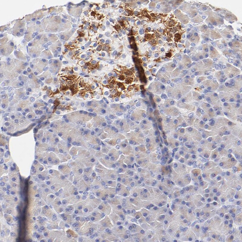 ASB9 Antibody - BSA Free Immunohistochemistry-Paraffin: ASB9 Antibody [NBP1-85081]