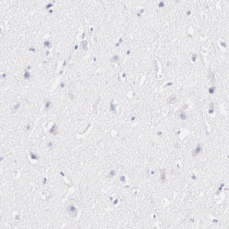 ASB9 Antibody - BSA Free Immunohistochemistry-Paraffin: ASB9 Antibody [NBP1-85081]