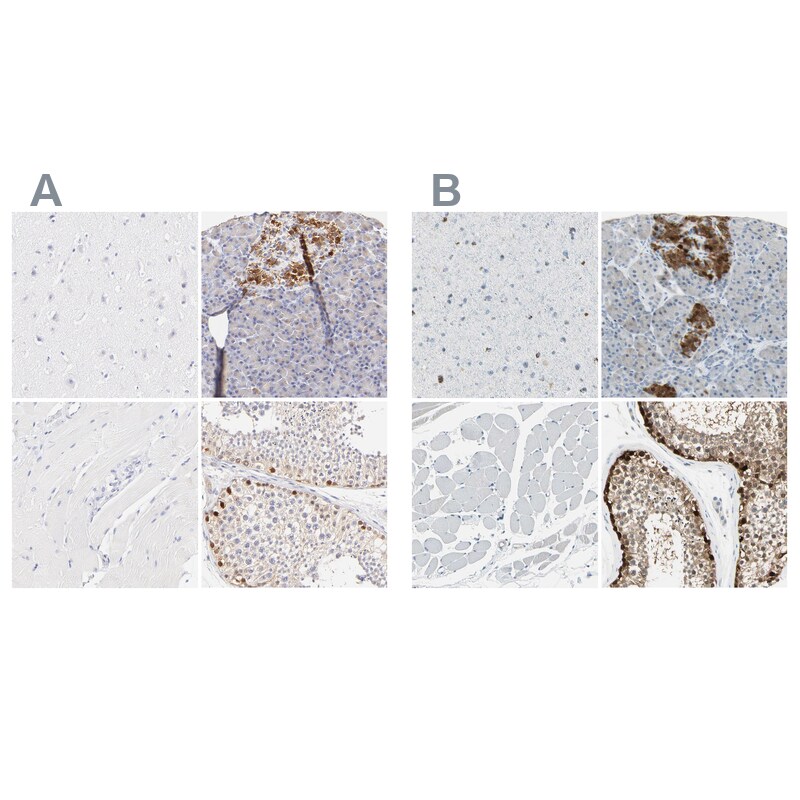 ASB9 Antibody - BSA Free Immunohistochemistry-Paraffin: ASB9 Antibody [NBP1-85081]