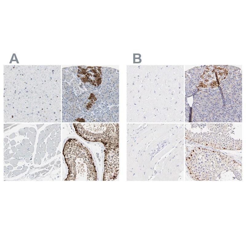 ASB9 Antibody Immunohistochemistry-Paraffin: ASB9 Antibody Antibody [NBP1-85082]