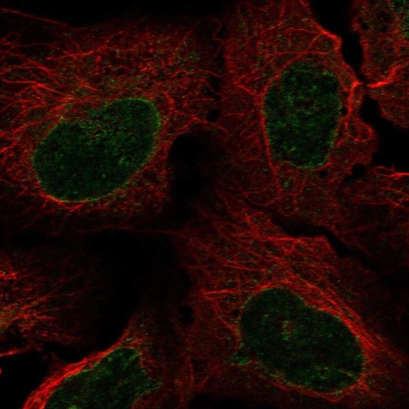 NUP62 Antibody - BSA Free Immunocytochemistry/ Immunofluorescence: NUP62 Antibody [NBP1-85091]