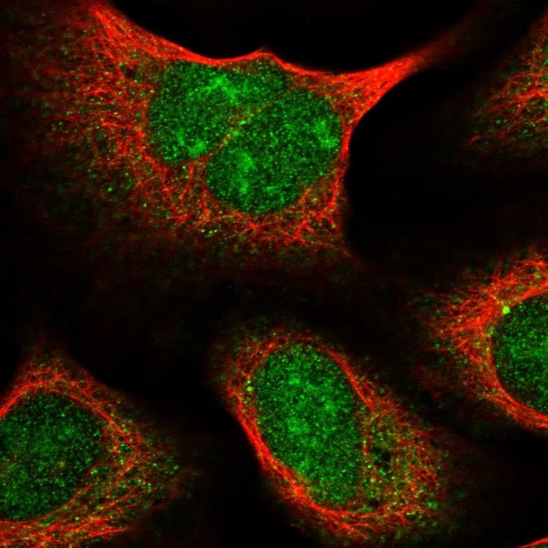 C1orf131 Antibody - BSA Free Immunocytochemistry/ Immunofluorescence: C1orf131 Antibody [NBP1-85097]