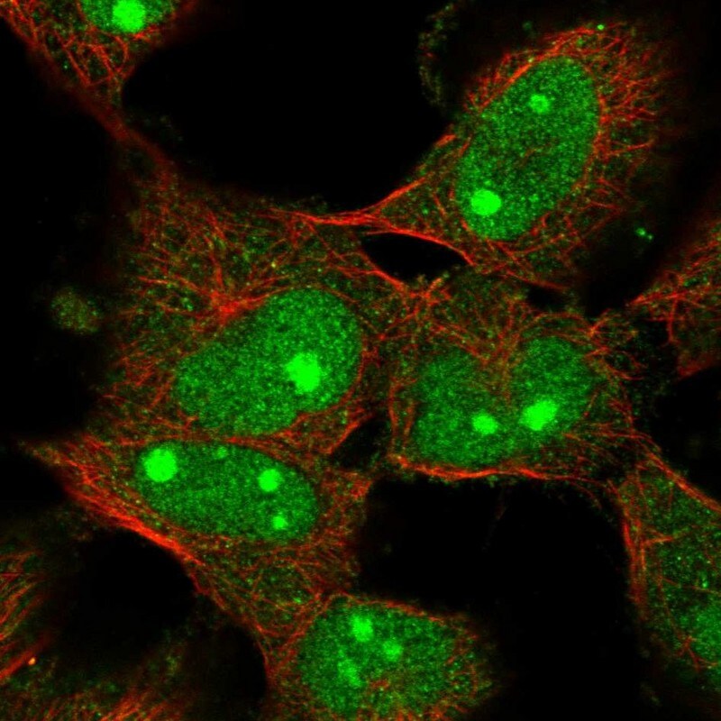 C1orf131 Antibody - BSA Free Immunocytochemistry/ Immunofluorescence: C1orf131 Antibody [NBP1-85098]