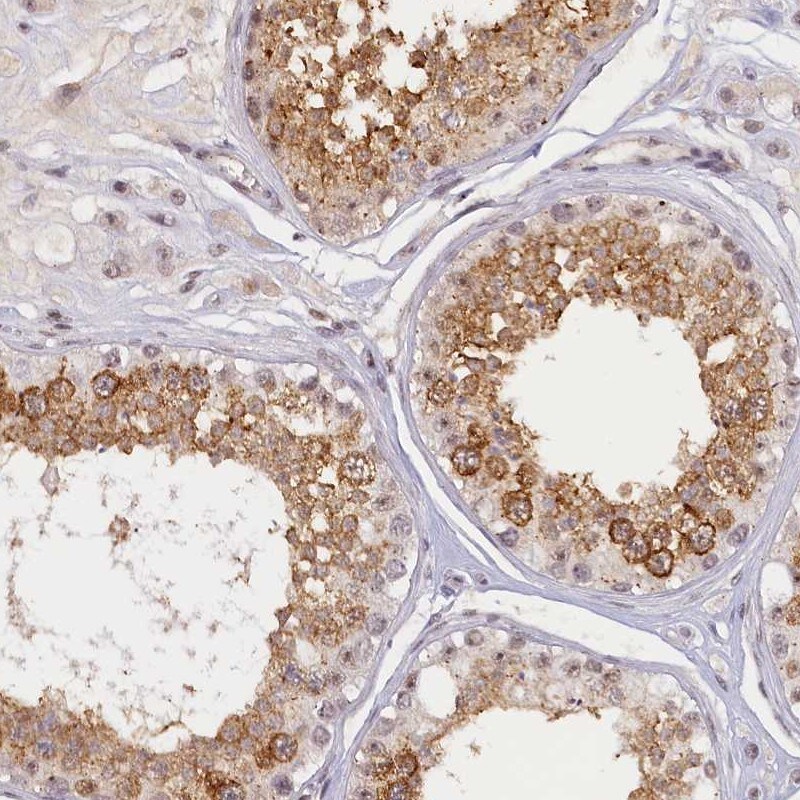SEC31B Antibody - BSA Free Immunohistochemistry: SEC31B Antibody - BSA Free [NBP1-85106]