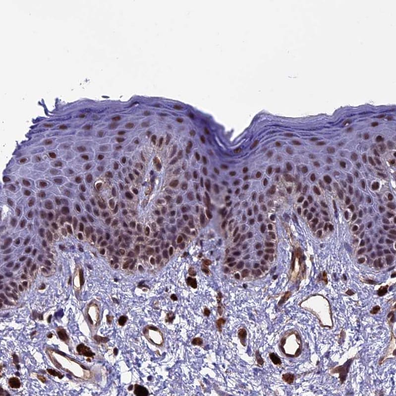 NIPBL Antibody - BSA Free Immunohistochemistry-Paraffin: NIPBL Antibody [NBP1-85110]