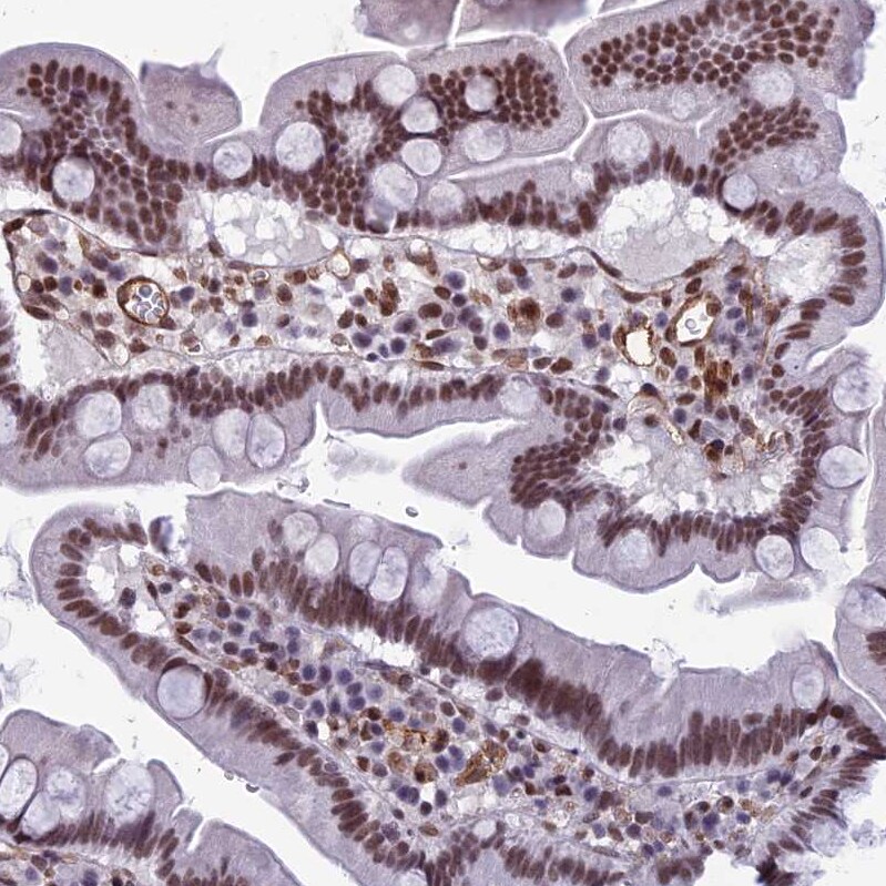 NIPBL Antibody - BSA Free Immunohistochemistry-Paraffin: NIPBL Antibody [NBP1-85110]